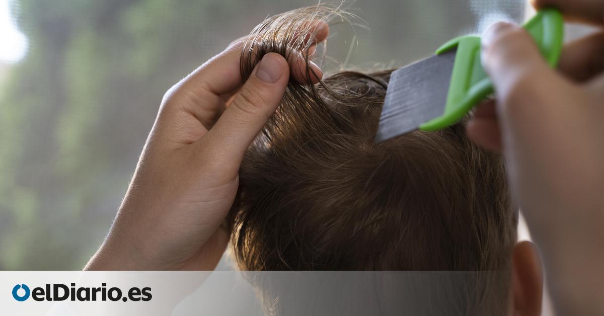 Mitos y verdades para acabar con los piojos, según una pediatra: “No prefieren el cabello sucio”