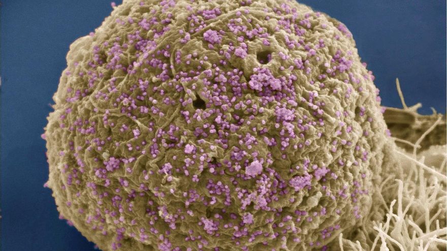 ¿Por qué hay varias vacunas contra el coronavirus y ninguna contra el VIH?