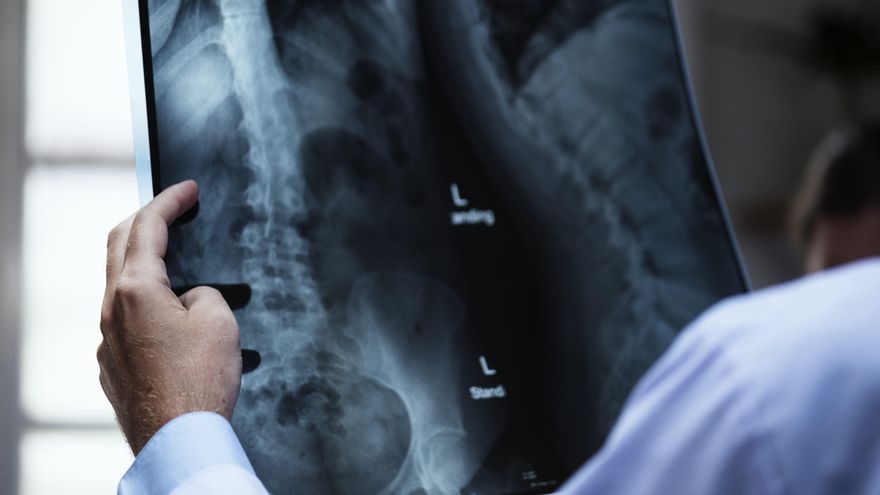 Llega a la Fiscalía el caso del fármaco contra la osteoporosis que causa un 'efecto rebote' al dejarlo