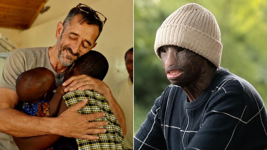 El doctor Pedro Cavadas despide la 'Operación África' de RTVE con lágrimas, reivindicación y una promesa: "La gente lo necesita"