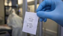 El estudio sobre la hidroxicloroquina ha motivado cambios de políticas en varios países.