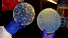 Muestras de bacterias incapaces de crecer en presencia de antibióticos (izquierda) y de bacterias multirresistentes (derecha)