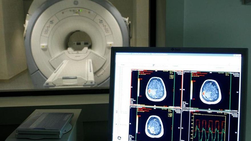 Científicos de EE.UU. desarrollan una nueva técnica diagnóstico para el Alzheimer