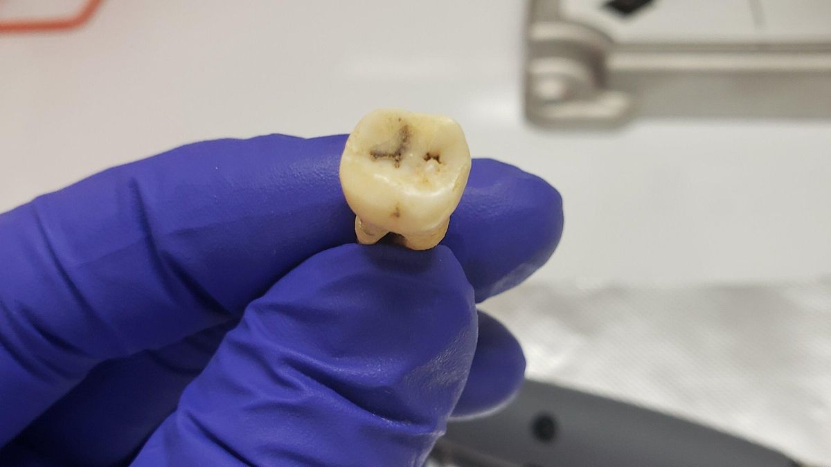 Diente del yacimiento arquitectónico de Jerash