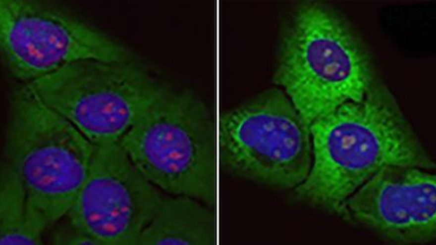 Investigadores españoles abren una vía inexplorada en la búsqueda de tratamientos contra la ELA
