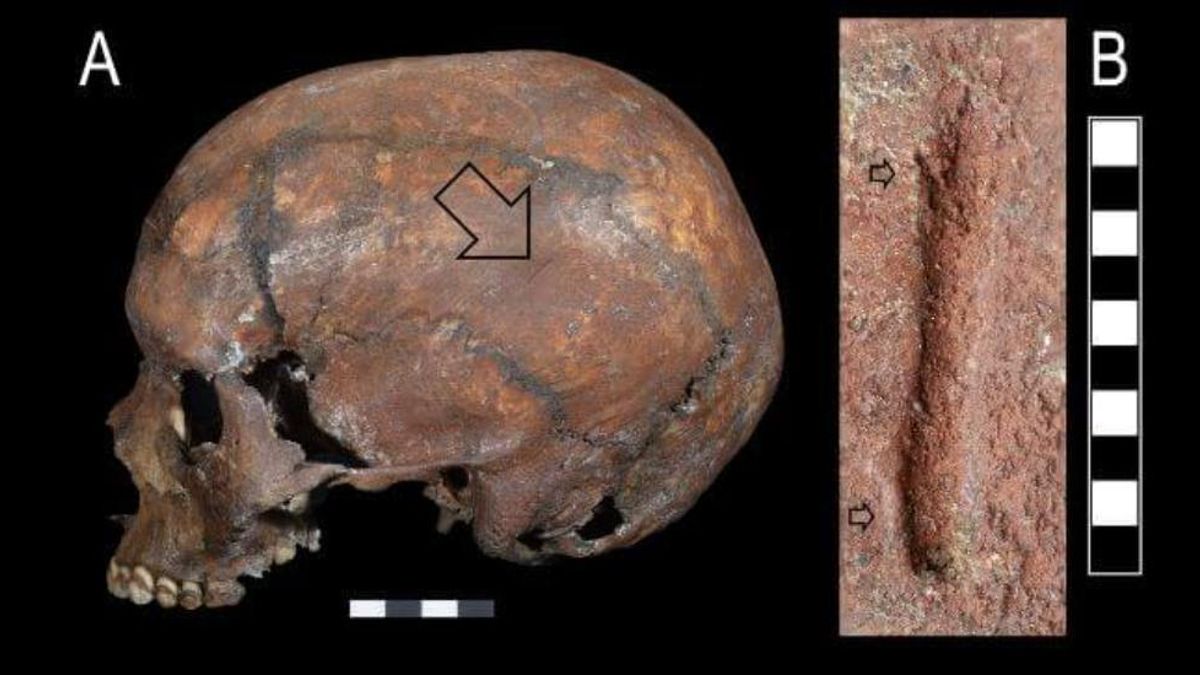 Las marcas óseas revelaron que sobrevivió entre dos y tres jornadas tras la agresión y que sufría dolencias previas en los pies