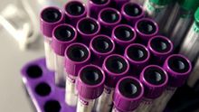 Los hospitales públicos pagan 307.200 euros por cada tratamiento personalizado contra la leucemia infantil