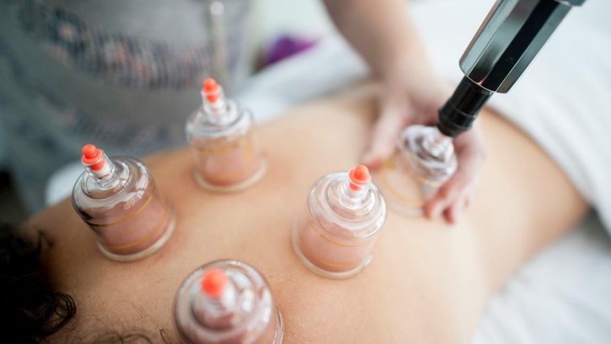 España vuelve a la carga contra las pseudoterapias y advierte contra el ‘cupping’, la aromaterapia y otros tratamientos