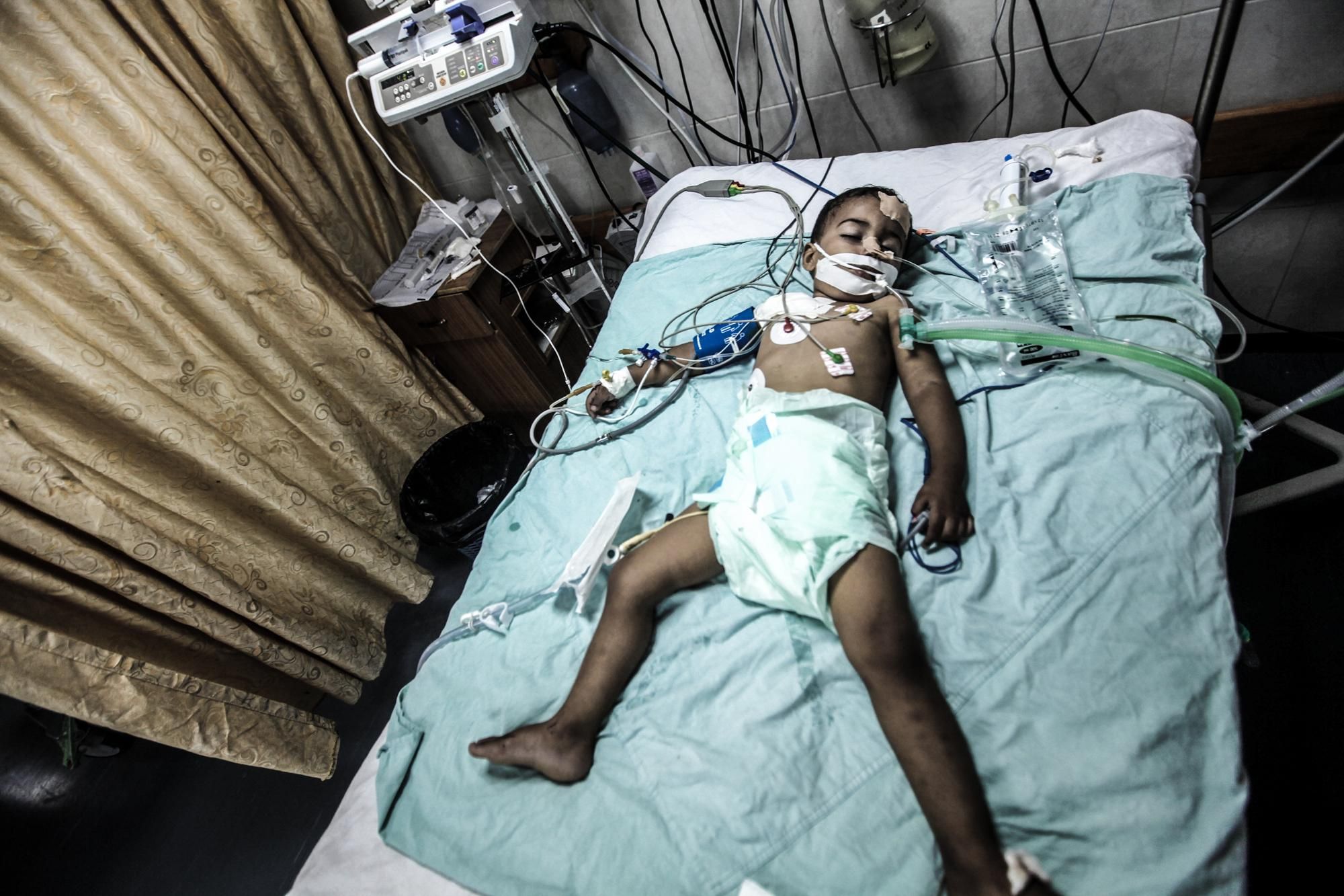 Un niño herido en un ataque israelí en un hospital de Gaza.  Foto: Momen Faiz/Zuma Press.