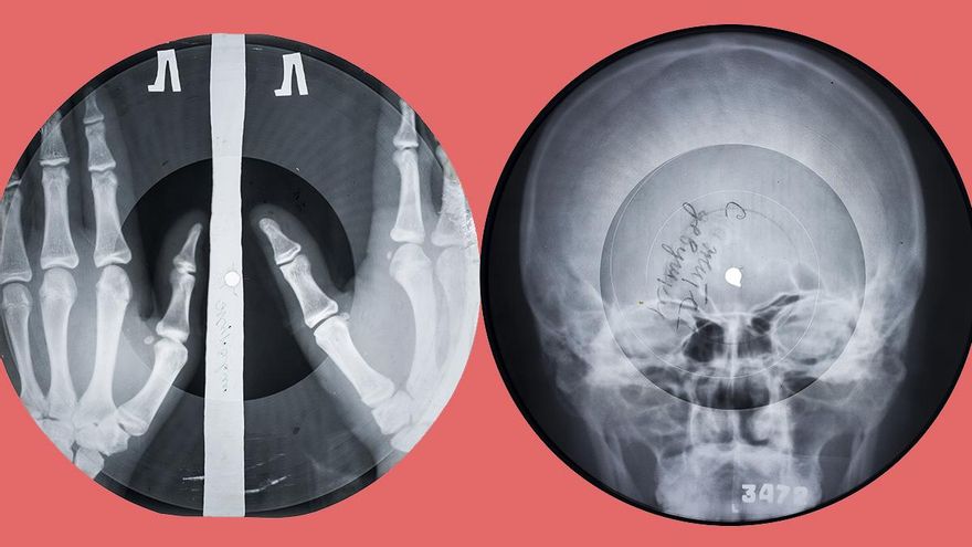 Un cráneo que suena a Elvis Presley: la música prohibida por la URSS que cruzó el telón de acero camuflada en radiografías