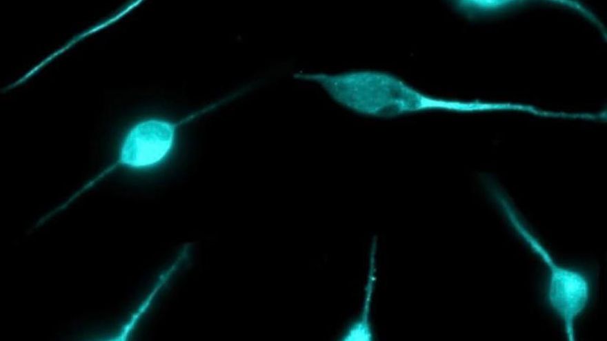 La importancia de la medicina personalizada en enfermedades raras