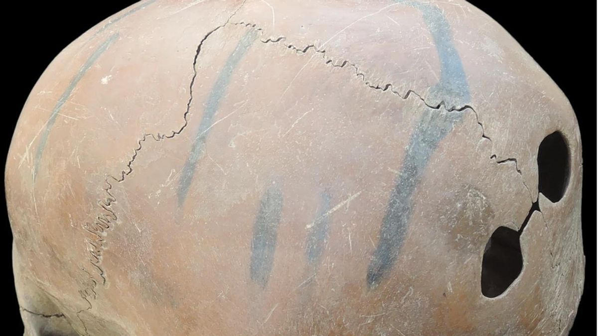 Cráneo con perforaciones posteriores (tipo D). Escala de 5 cm.