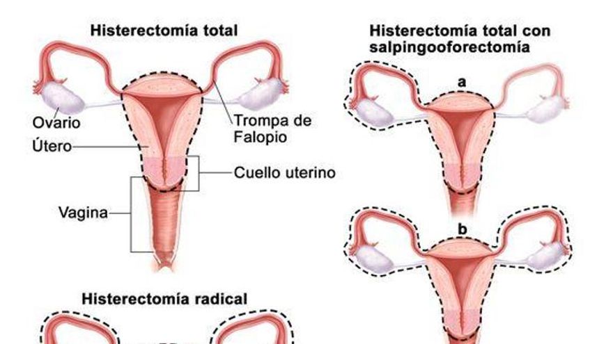 Operaron a Cristina Fernández: se le detectó un "pólipo uterino" de "características benignas"