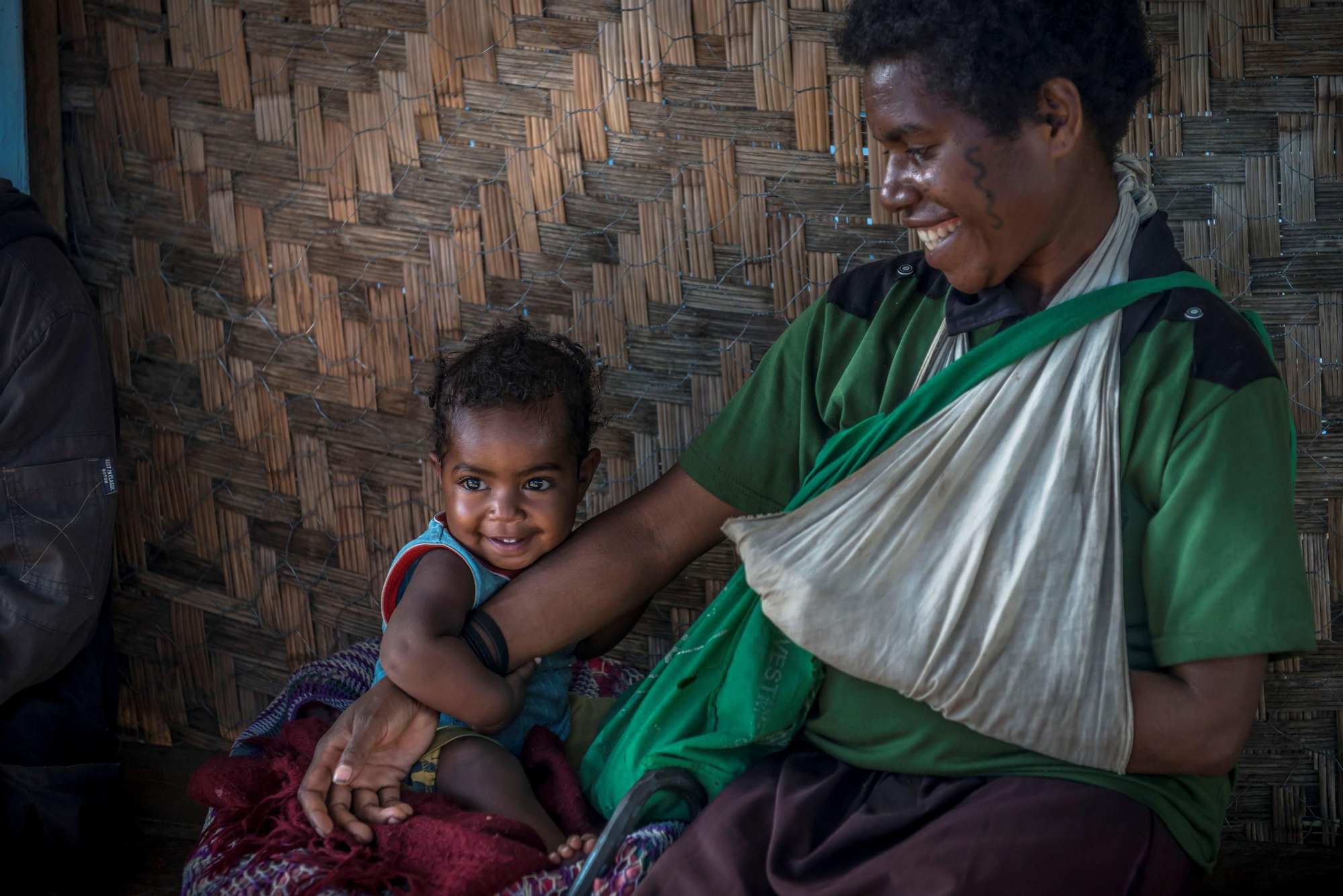 “Necesitamos ser muy activos en la generación de conciencia para proteger a nuestros niños". Una madre herida y su hija en el centro de apoyo familiar de MSF en el Hospital de Tari.