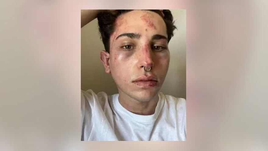 Agresión homófoba a un joven en una discoteca de València a grito de "la gente como tú tiene que morir"