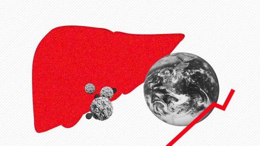 De estar casi erradicada a repunte mundial: la hepatitis D vuelve a infectar