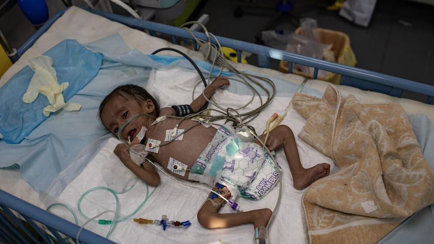 Expertos de la ONU alertan de que los niños están muriendo por desnutrición en toda la Franja de Gaza