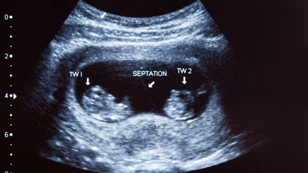 Los estudios indican que los factores genéticos influyen en la probabilidad de concebir gemelos.