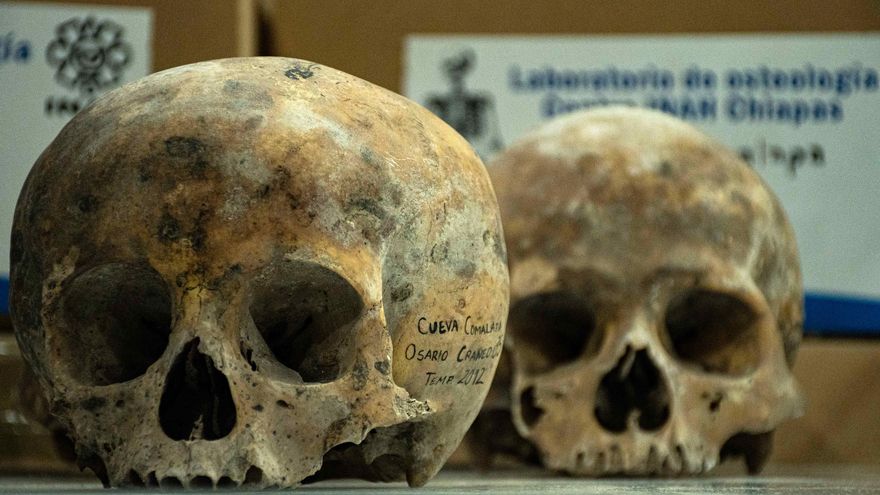 El legado de los neandertales podría explicar una malformación neurológica actual