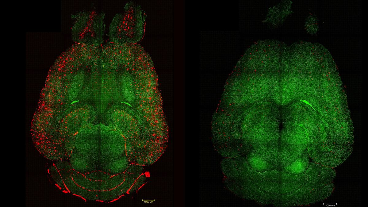 El cerebro de un ratón antes y después del experimento (en rojo, las placas del alzhéimer).