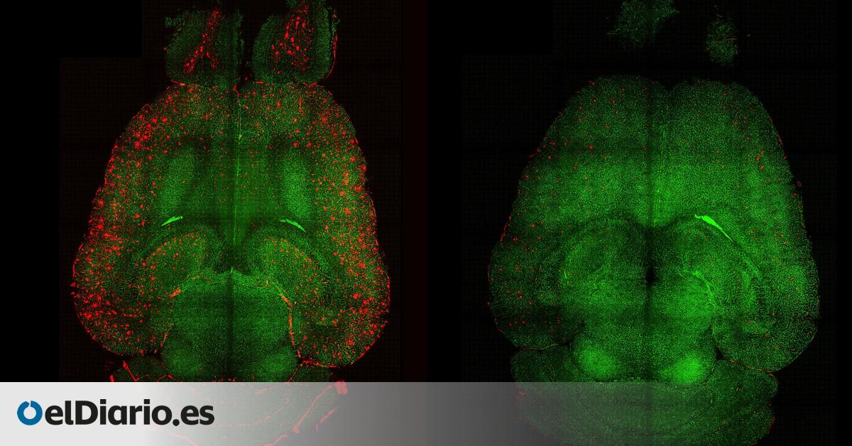Científicos españoles logran revertir el alzhéimer en ratones restaurando la barrera hematoencefálica