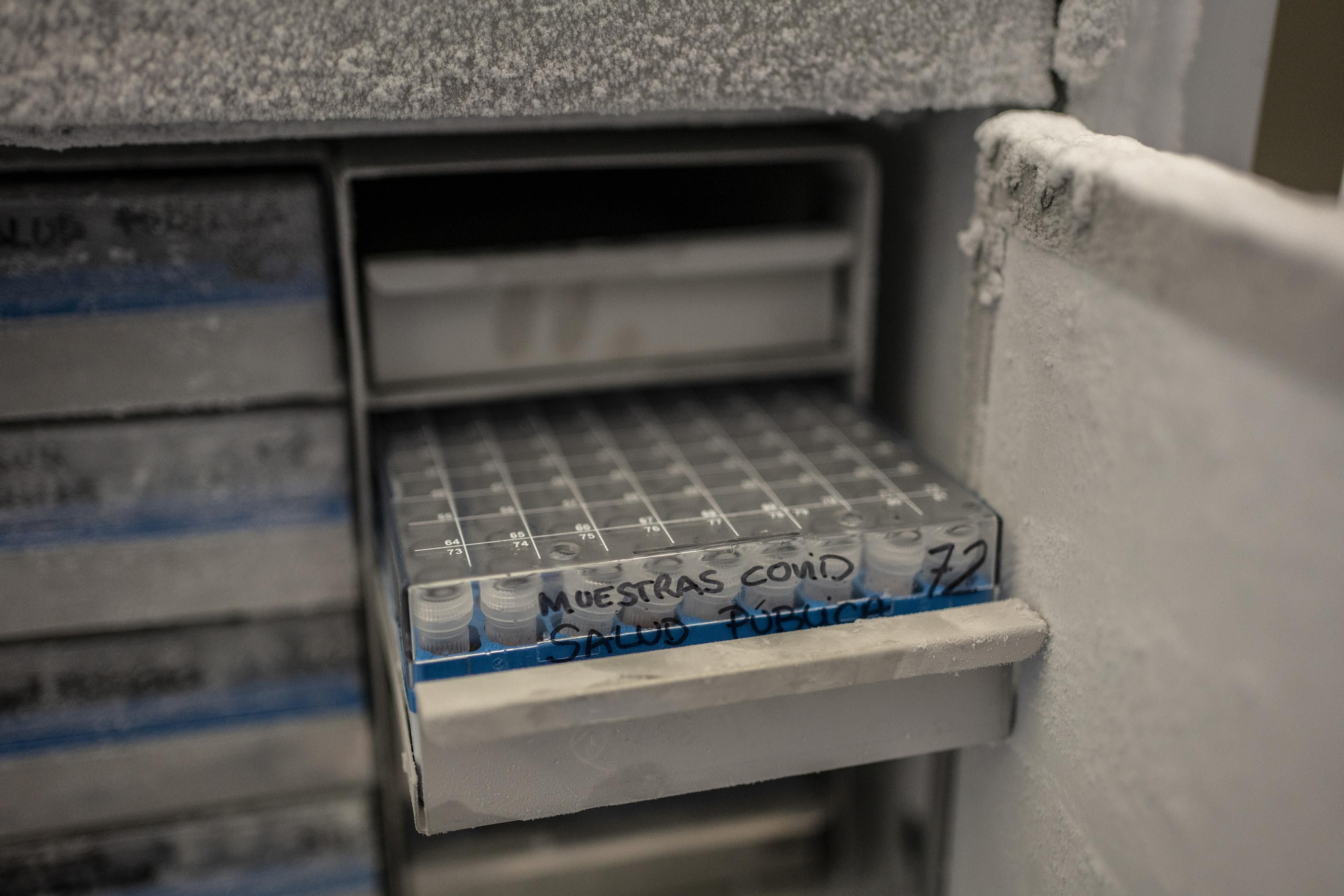 Las muestras COVID-19 se guardan a menos 80 grados centígrados.