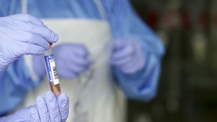 Prueba PCR para diagnosticar la COVID-19.