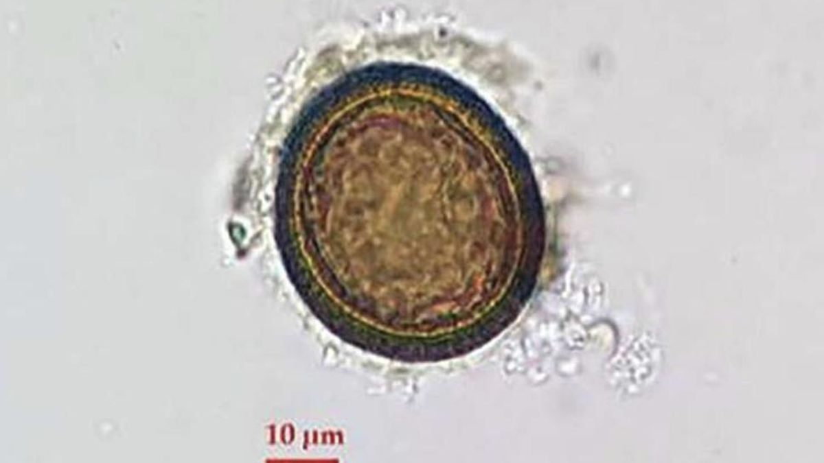 Las condiciones domésticas explicaron la persistencia de infecciones