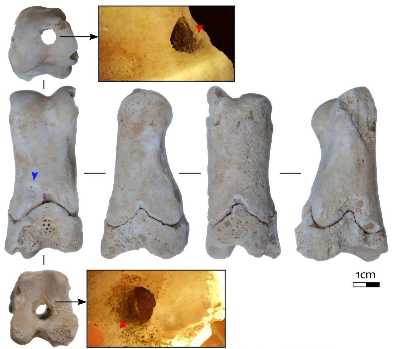 Falange con una sola perforación a lo largo de su longitud