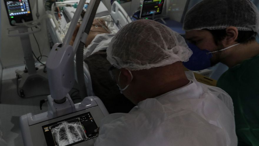 Médicos observan una imagen de rayos x de un paciente con coronavirus en la UTI del hospital de Campaña de Riocentro, en la zona oeste de Río de Janeiro (Brasil). EFE/Antonio Lacerda