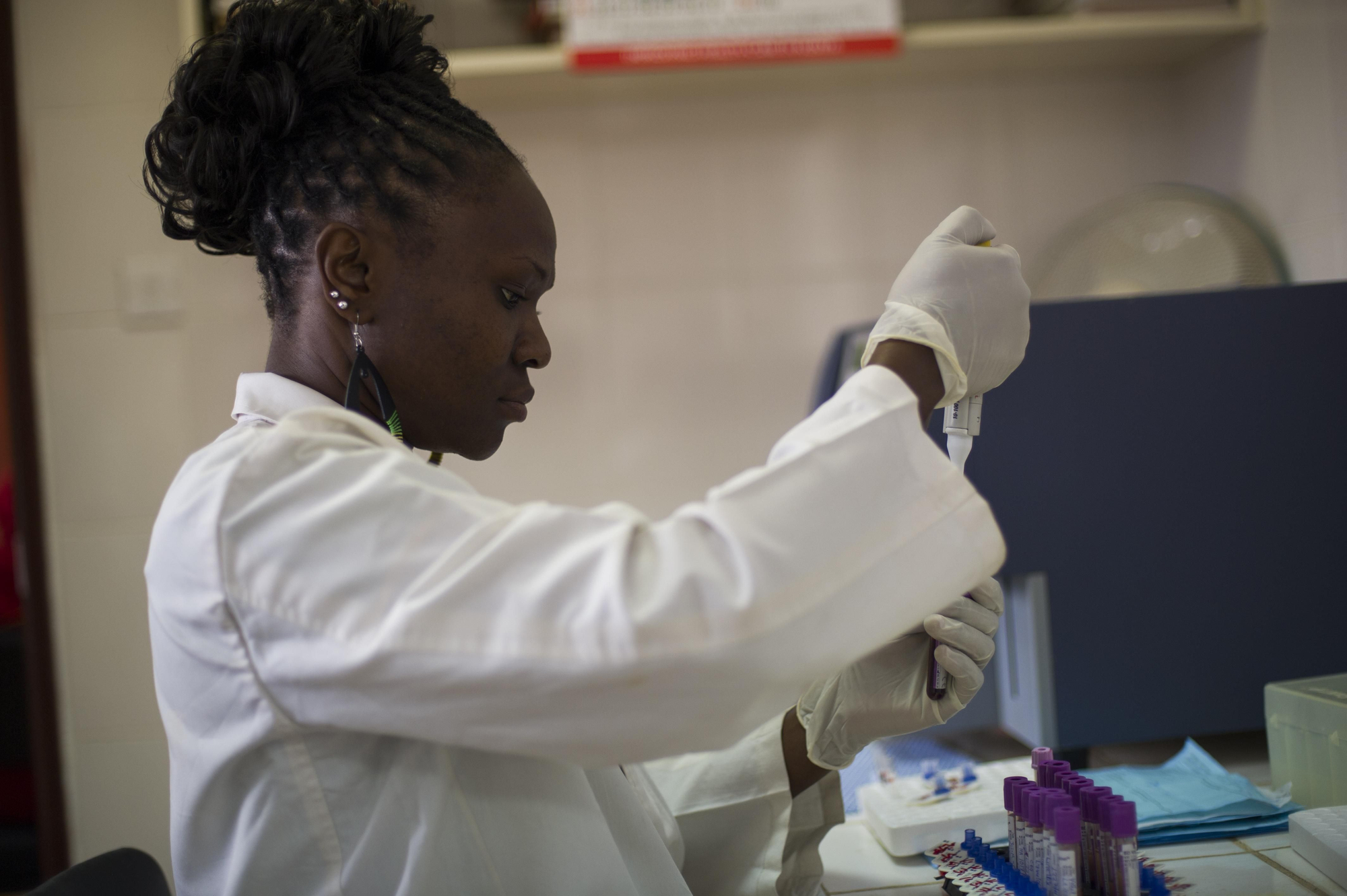 Mercy Oluya, técnica de laboratorio, comprueba los niveles de inmunización en sangre en el laboratorio del centro. El diagnóstico precoz es fundamental para combatir enfermedades como la tuberculosis. Así, cuánto antes reciba un enfermo de tuberculosis un diagnóstico de la enfermedad y comience el tratamiento más posibilidades tendrá de curarse y antes dejará de ser potencialmente infeccioso. Fotografía: Phil Moore