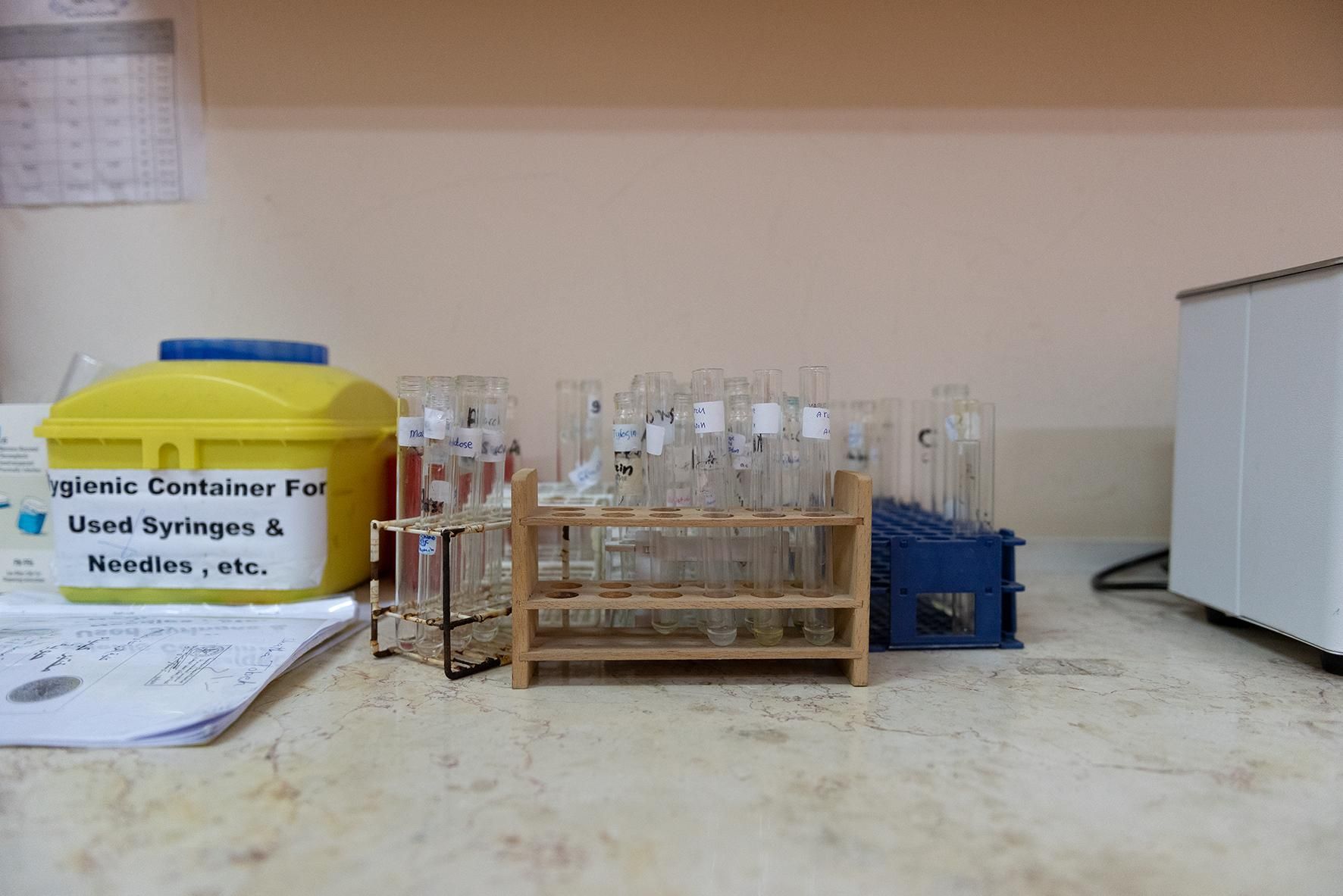 Probetas en un laboratorio