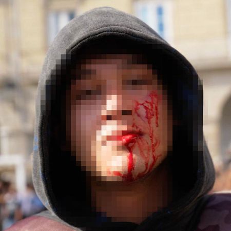 Uno de los jóvenes heridos en las cargas