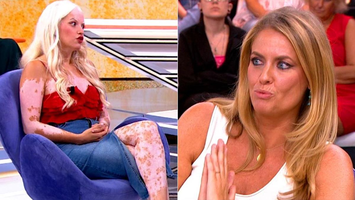 Pepa Romero entrevista a una madre y un hijo con piebaldismo