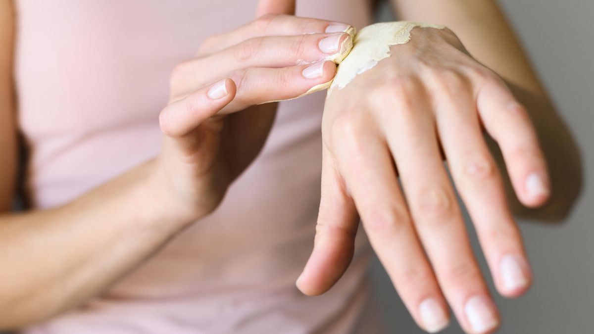 Ni hielo ni pasta de dientes: una enfermera explica cómo reaccionar ante una quemadura en la cocina