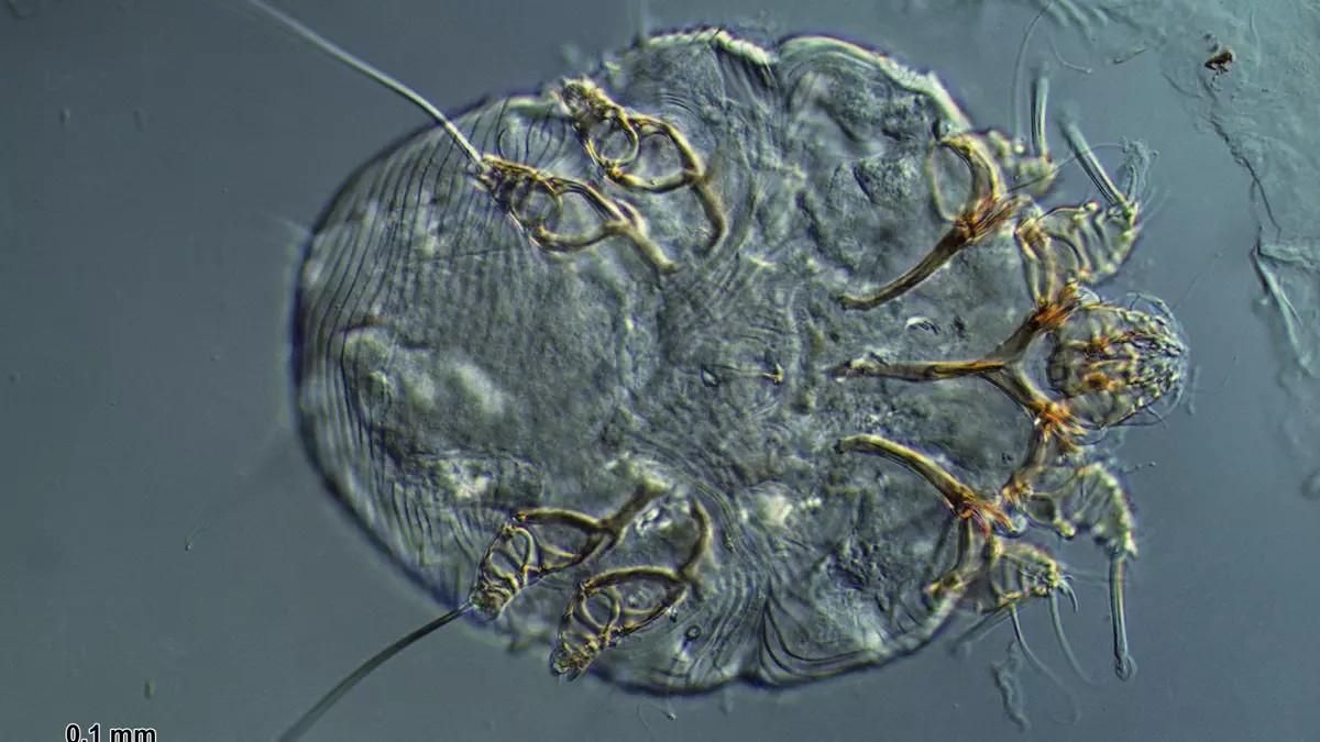 Parásito de la sarna humana