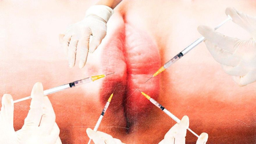 Complejo por tener "labios grandes" u oscuros: la presión estética (y el mercado) también llega a las vulvas