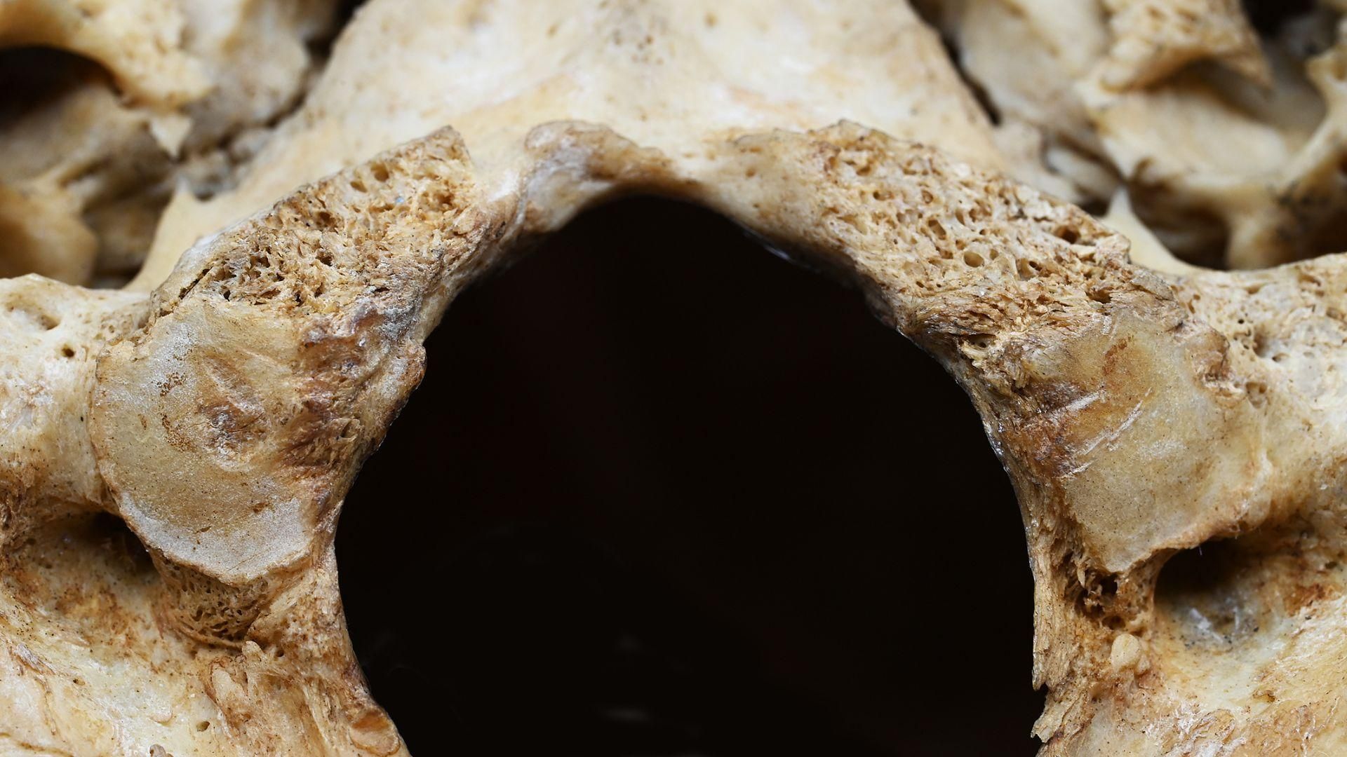 Lugar donde se une la columna vertebral y el cráneo.