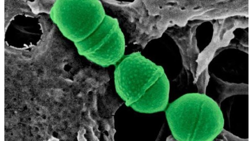Streptococcus dentisani de microscopía electrónica coloreada.