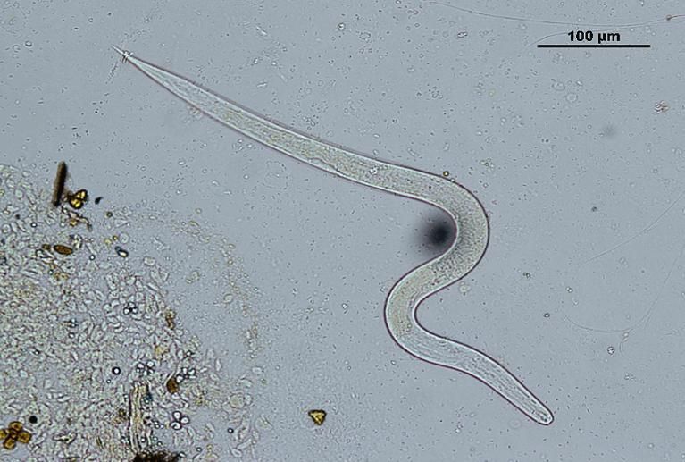 Angiostrongylus cantonensis en baba de caracol. Este parásito, que los caracoles africanos pueden portar, podría representar un riesgo para la salud humana, ya que está asociado a casos de meningitis