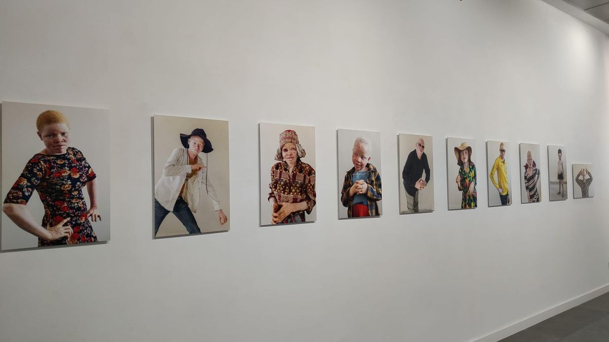 Algunas de las fotografías de la exposición 'En nuestra piel'