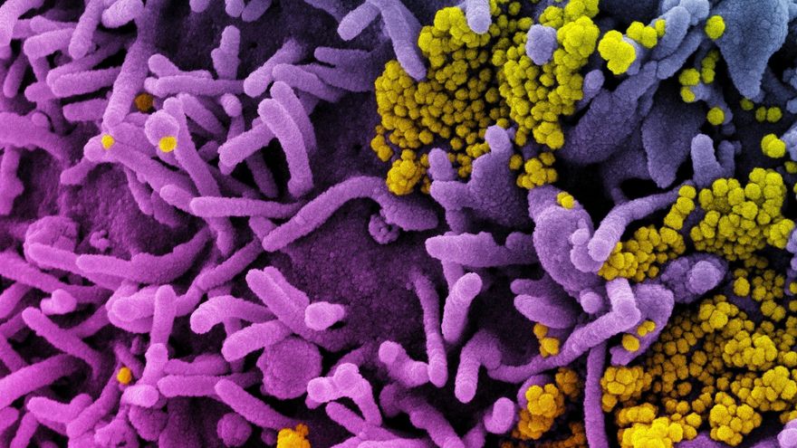 Cómo ha afectado la pandemia a nuestra microbiota