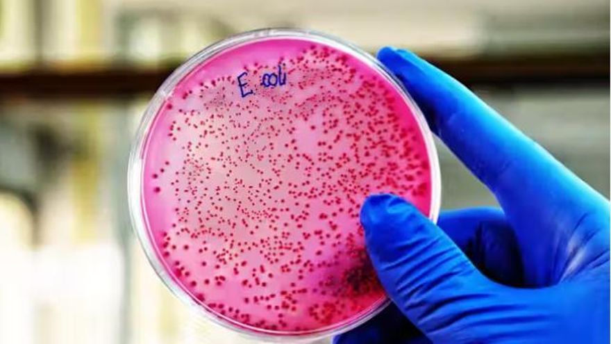 Qué es E.coli, la bacteria que ha enfermado a una triatleta olímpica belga tras nadar en el Sena