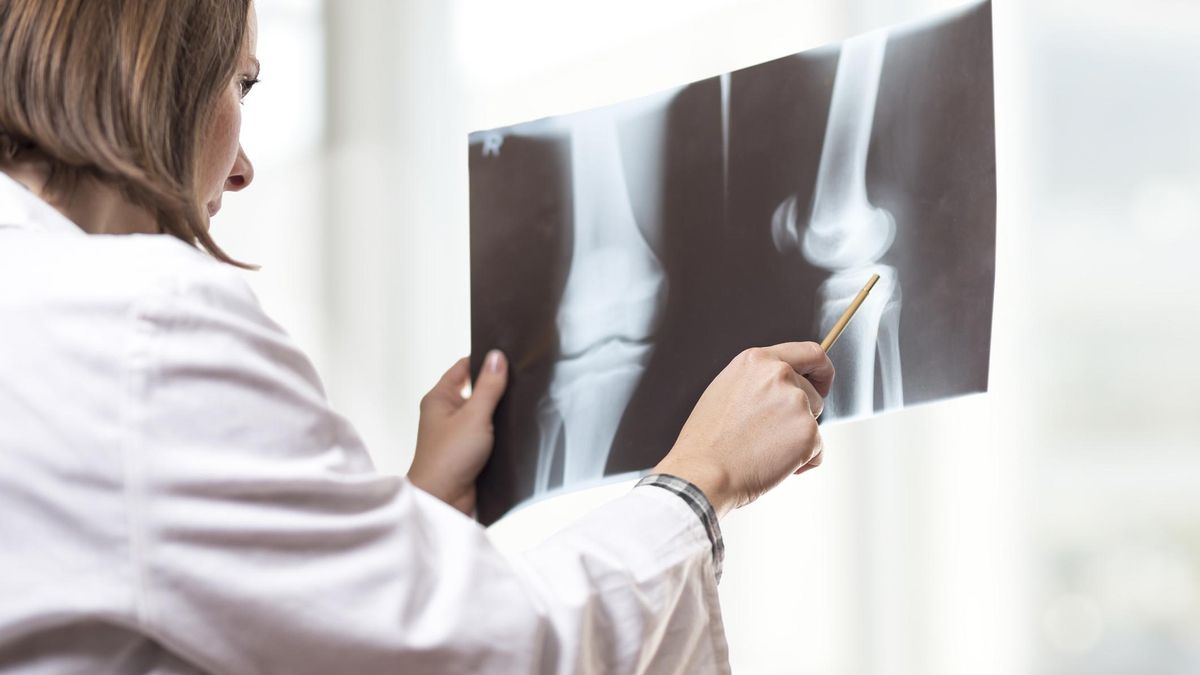 Una doctora examina una radiografía de rodilla