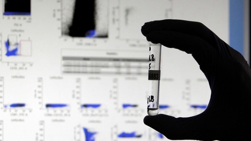 Investigadores del Hospital General Universitario de Alicante, utilizando tecnología del CSIC, han desarrollado un nuevo test de "extrema" sensibilidad capaz de detectar anticuerpos contra la covid-19 hasta ahora invisibles en pacientes que han superado el virus y que aparentemente no habían generado inmunidad alguna. EFE/Pep Morell