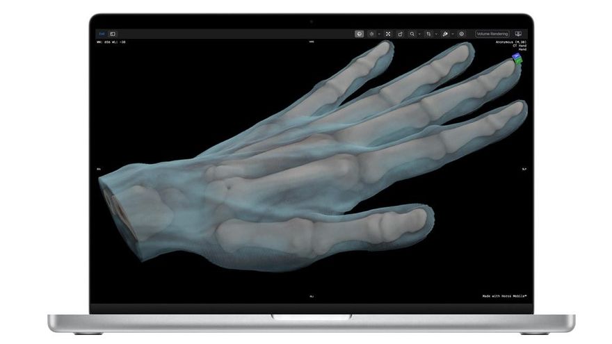 Las grandes tecnológicas dan el salto al negocio sanitario