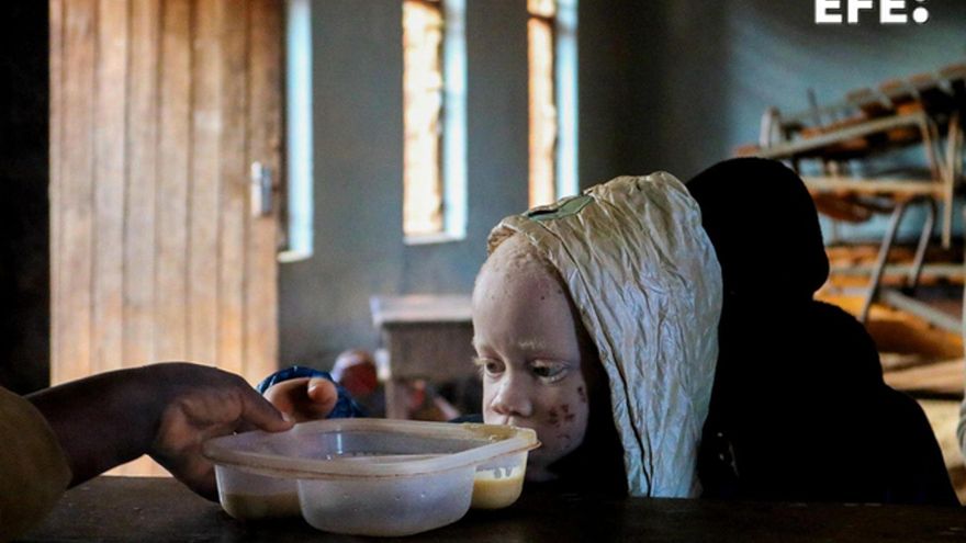 Donde la discapacidad no es una incapacidad: el colegio que rompe barreras en Malaui