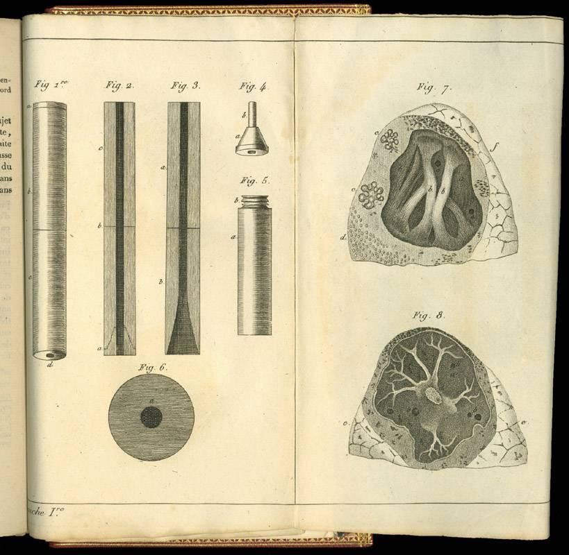 En 1816, el médico francés René Laennec inventó el estetoscopio para diagnosticar a personas con tuberculosis