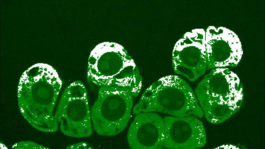 Qué es el óxido nítrico, por qué te importa y cómo aumentarlo