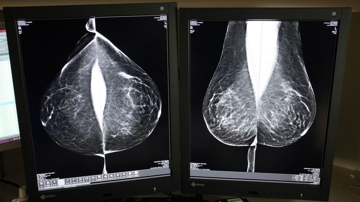 Estudio una mamografía digital, en el servicio de mamografías del Hospital Río Hortega de Valladolid.